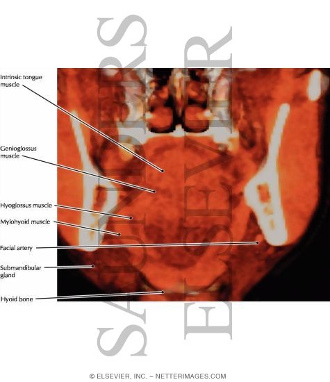Watermarked preview of labeled image: Tongue, Coronal Section
