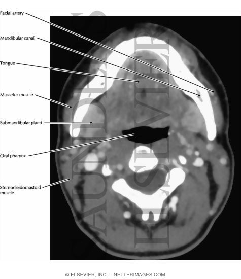 Submandibular and Sublingual Salivary Glands