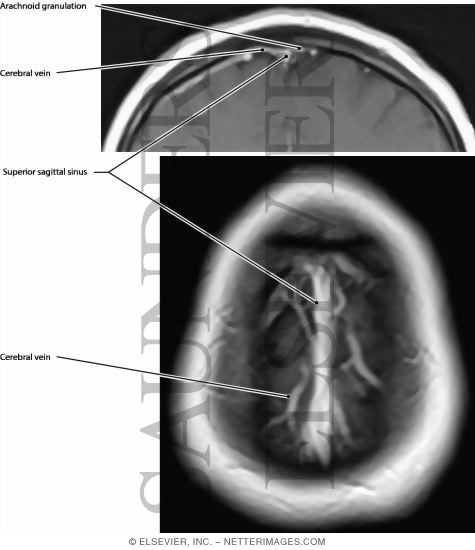 Superior Sagittal Sinus