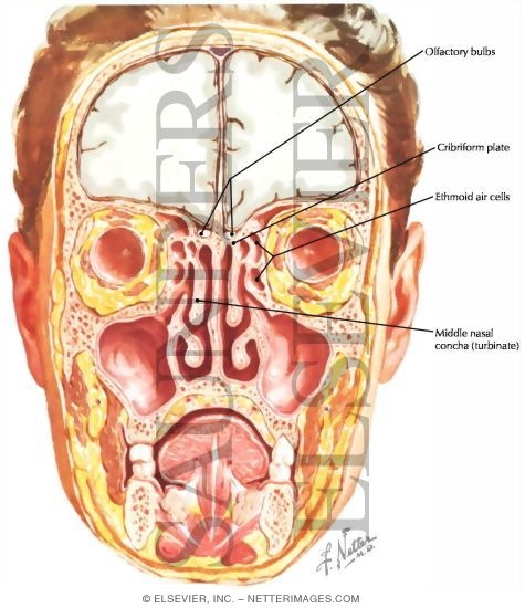 Watermarked preview of labeled image: Olfactory Bulbs