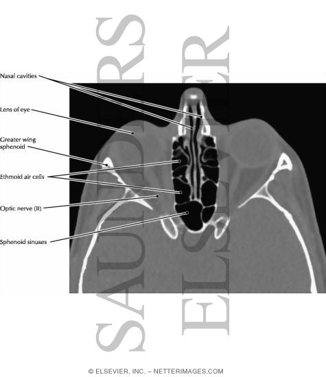 Ethmoid Air Cells and Sphenoid Sinus