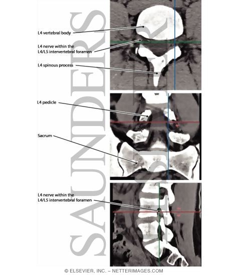 Lumbar Spine