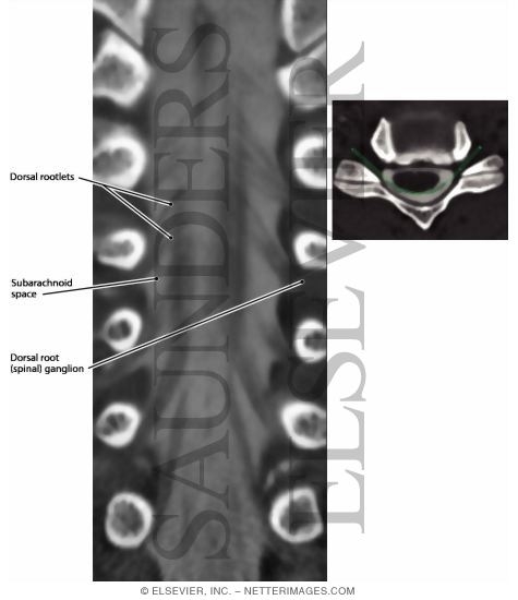 Spinal Cord, Nerve Roots