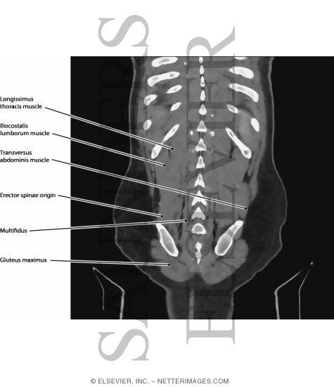 Back, Lower Paraspinal Muscles