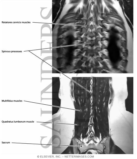 Deep Muscles of the Back