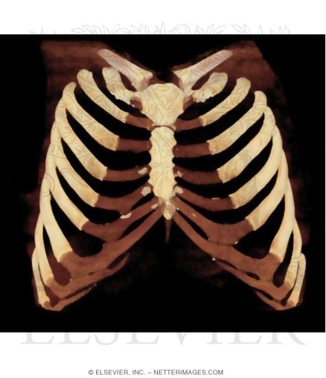 Watermarked preview of unlabeled image: Anterior Chest Wall