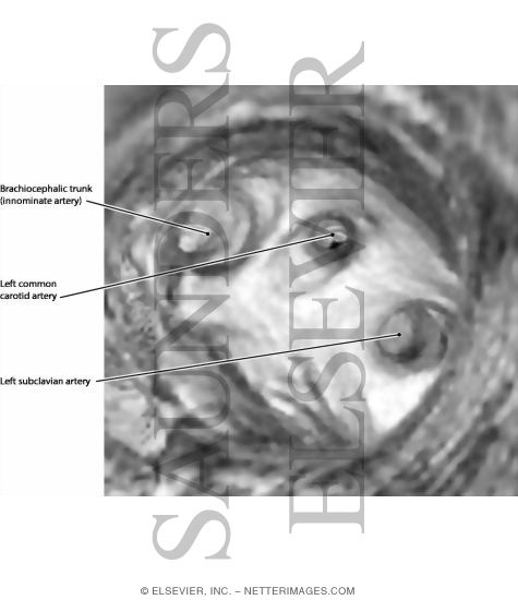 Branches of the Arch of Aorta