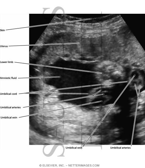 Watermarked preview of labeled image: Umbilical Cord