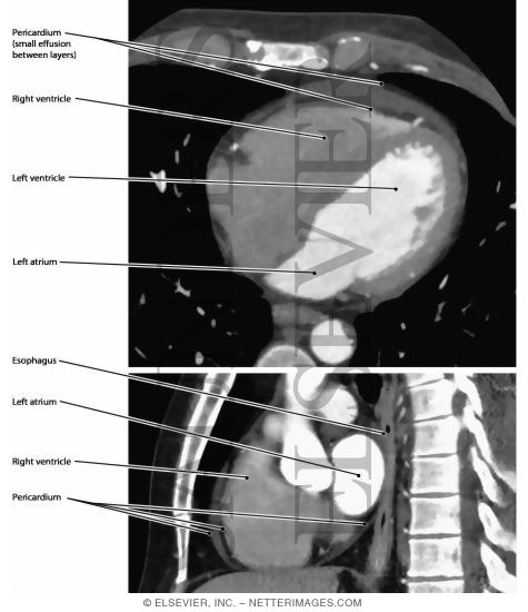 Pericardium, Mediastinum Section
