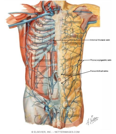 Watermarked preview of labeled image: Veins of Anterior Abdominal Wall
Venous Drainage of the Abdomen