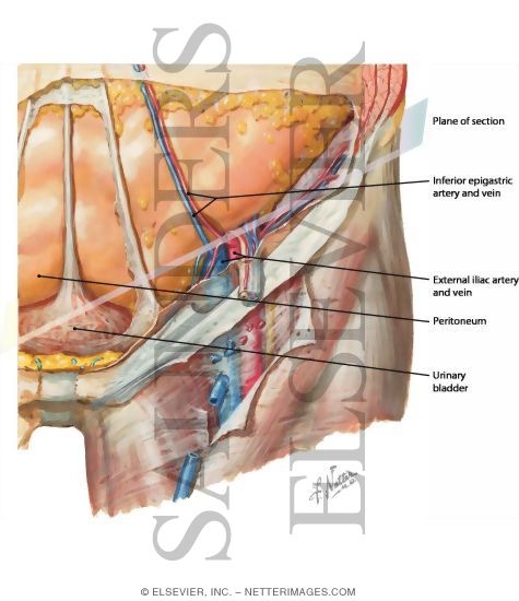 Watermarked preview of labeled image: Inguinal Region