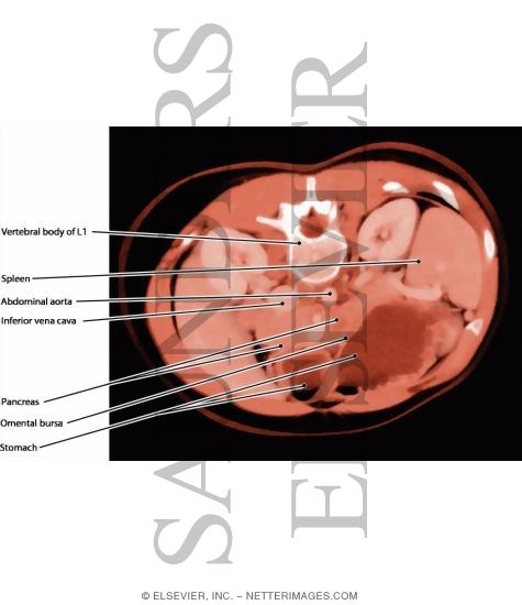 Watermarked preview of labeled image: Omental Bursa, Oblique Section
