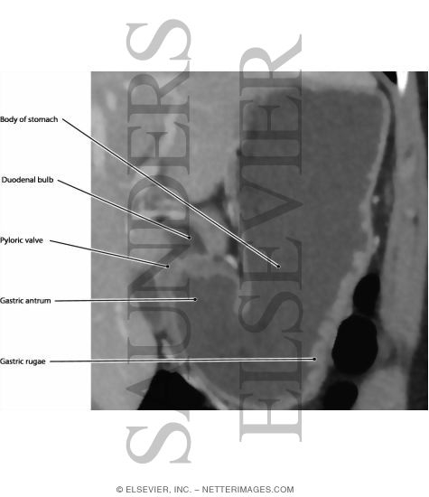 Watermarked preview of labeled image: Stomach, In Situ
