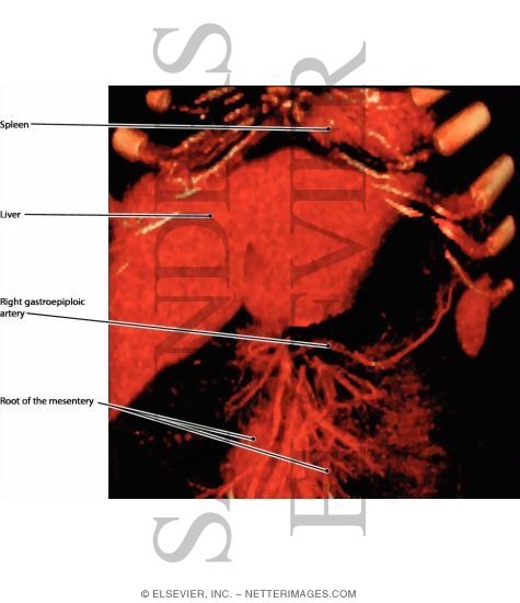 Watermarked preview of labeled image: Porta Hepatis and Greater Omentum