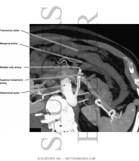 Marginal Artery (of Drummond)