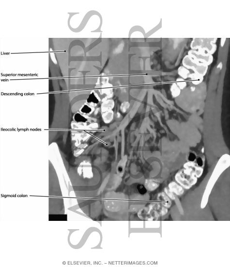 Mesenteric Lymph Nodes
