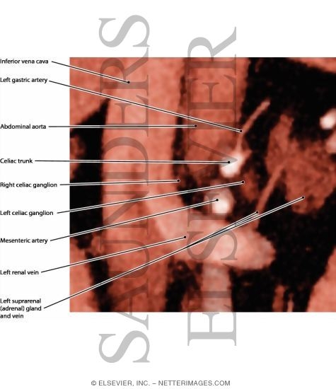 Celiac Plexus