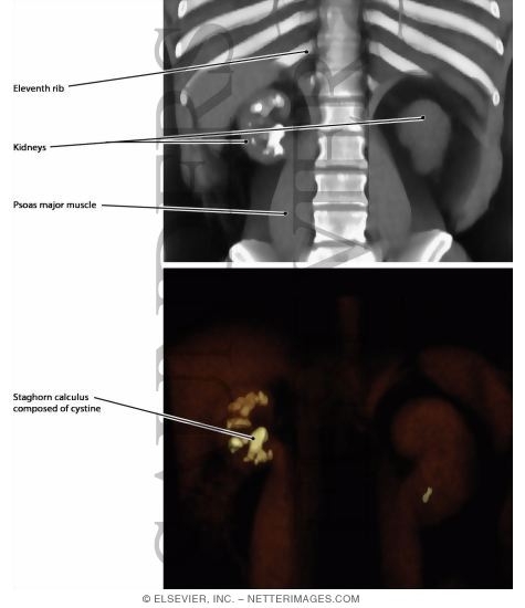 Watermarked preview of labeled image: Kidneys and Ureters