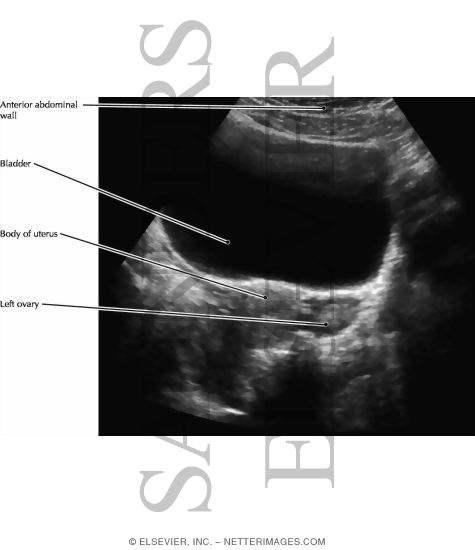 Uterus and Adnexa
