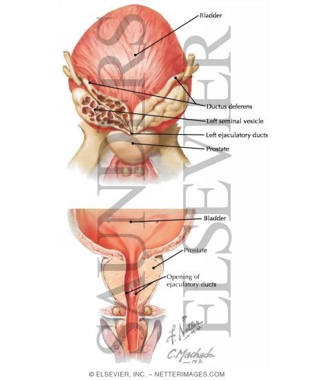 Watermarked preview of labeled image: Bladder, Prostate, and Seminal Vesicles