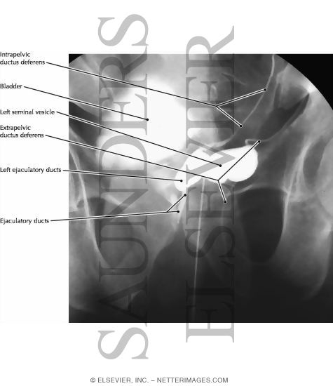 Bladder, Prostate, and Seminal Vesicles