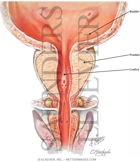 Prostate, Coronal View