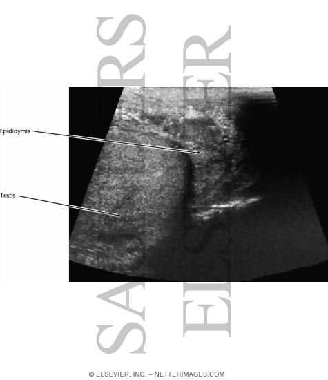Watermarked preview of labeled image: Testis and Epididymis