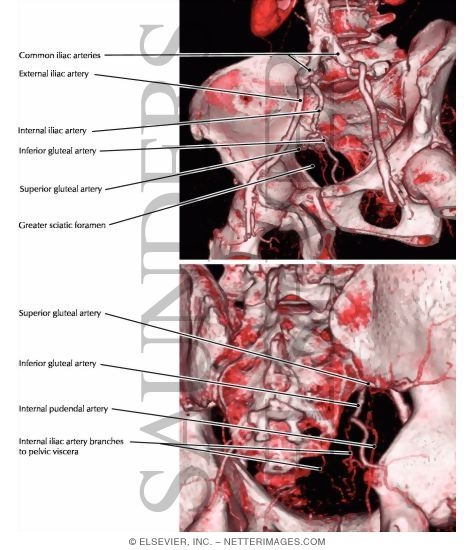 Common, Internal, and External Iliac Arteries