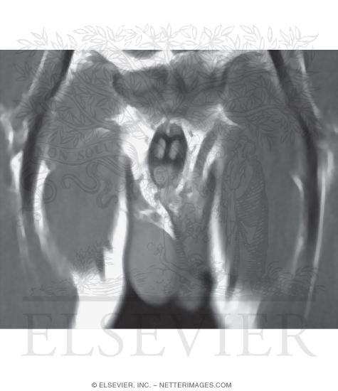 Penis, Cross Section