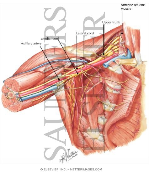 Axilla Dissection: Anterior View

