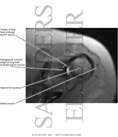 Watermarked preview of labeled image: Anterior View of the Shoulder Girdle