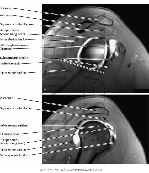 Shoulder Joint, Glenoid Fossa