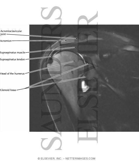 Shoulder Joint, Supraspinatus Muscle