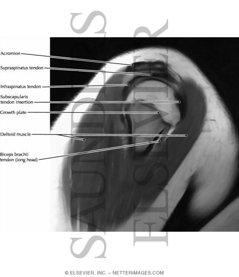 Shoulder Joint, Anterior and Sagittal Views