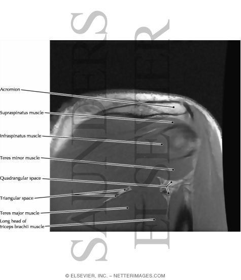 Quadrangular and Triangular Spaces