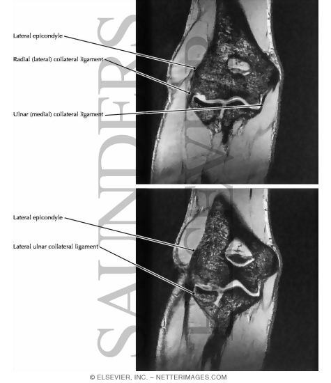 Watermarked preview of labeled image: Elbow, Anterior Perspective