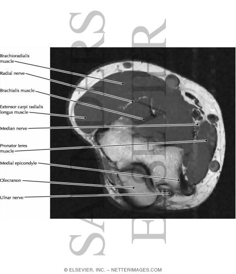 Elbow, Ulnar Nerve