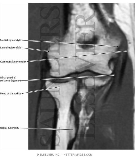 Forearm, Medial Musculature