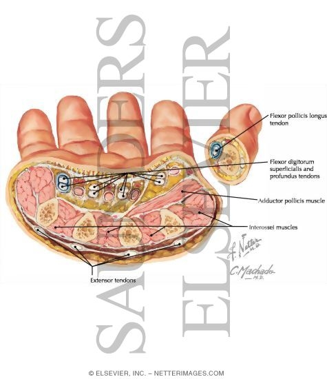 Watermarked preview of labeled image: Hand, Axial Section