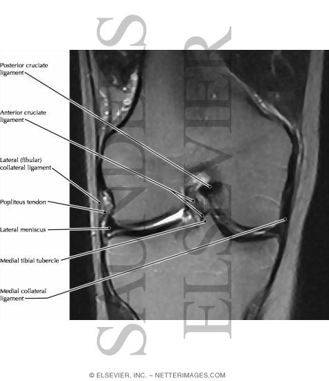 Watermarked preview of labeled image: Knee Joint, Anterior View