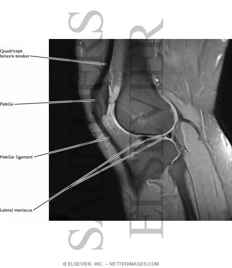 Knee Joint, Lateral View