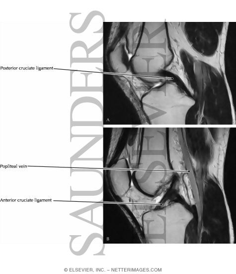 Watermarked preview of labeled image: Cruciate Ligaments