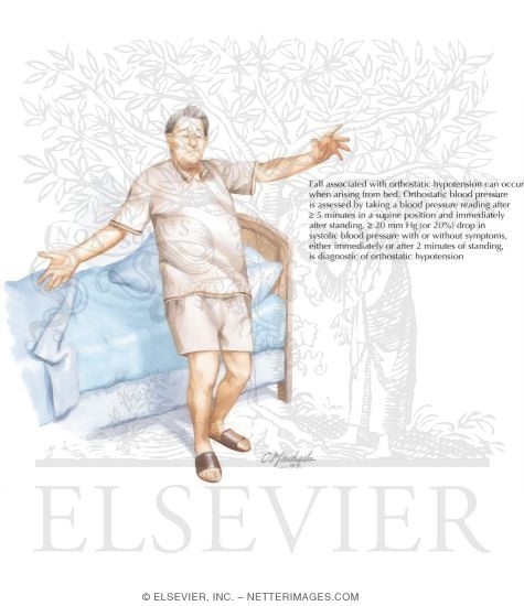 Watermarked preview of labeled image: Orthostatic Hypotension: Man Falling