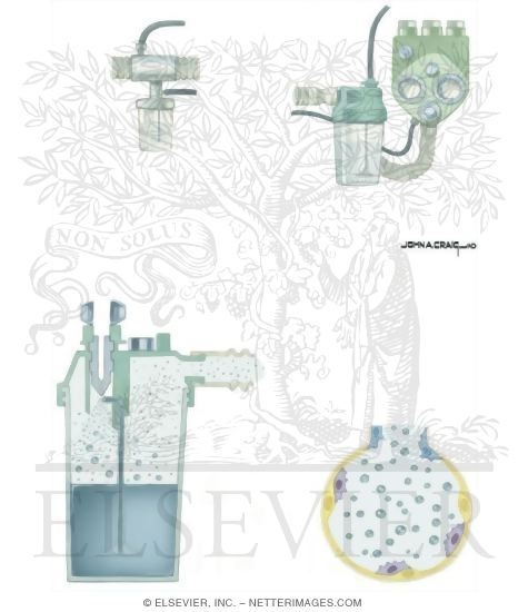 Watermarked preview of unlabeled image: Nosocomial Infections: Mechanisms of Nebulizer Contamination