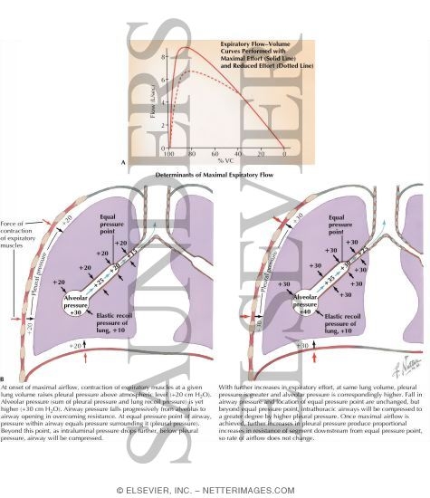 Watermarked preview of labeled image: Flow-Volume Relationships - Determinants of Maximal Expiratory Flow