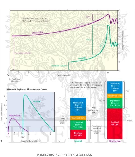 Watermarked preview of labeled image: Obstructive Lung Disease