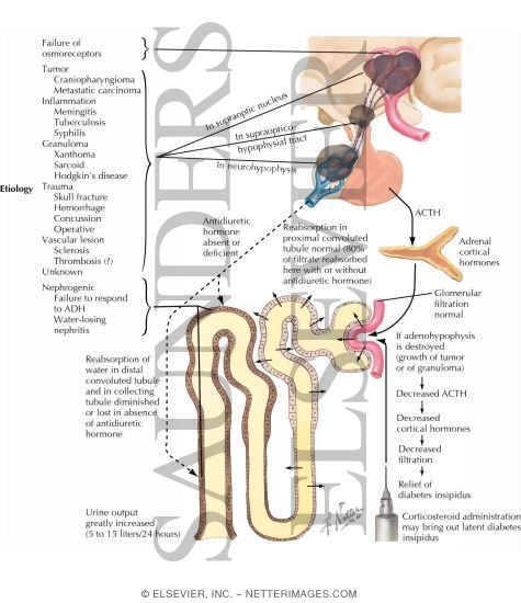 diabetes insipida central pdf