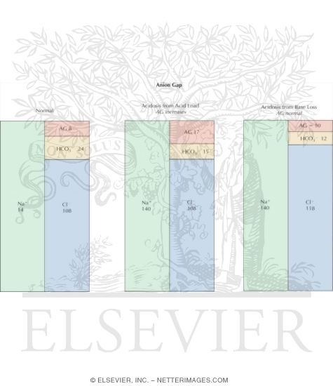 Watermarked preview of unlabeled image: Plasma Anion Gap