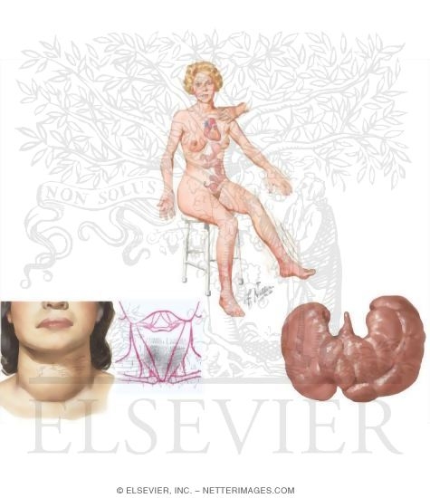 Watermarked preview of unlabeled image: Clinical Symptoms of Hyperthyroidism