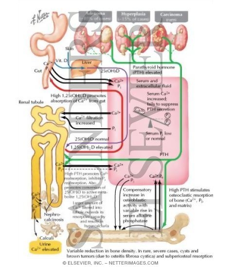 Pathophysiology of Primary Hyperparathyroidism